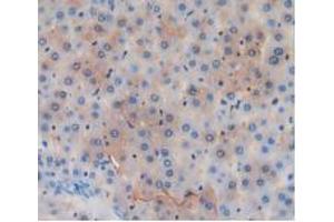 Figure. (GSTA4 antibody  (AA 2-222))