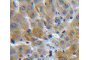 Used in DAB staining on fromalin fixed paraffin-embedded Liver tissue (MBL2 antibody  (AA 42-96))