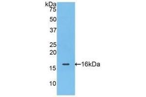 Detection of Recombinant FABP4, Mouse using Polyclonal Antibody to Fatty Acid Binding Protein 4 (FABP4) (FABP4 antibody  (AA 2-132))