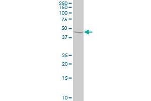 STAM2 monoclonal antibody (M01), clone 1A10 Western Blot analysis of STAM2 expression in HeLa . (STAM2 antibody  (AA 416-525))