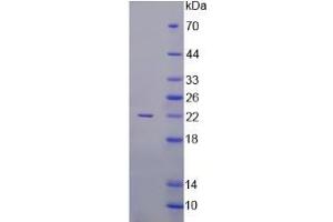 Image no. 1 for Activin A (ACVA) (AA 44-178) protein (His tag) (ABIN3209854) (ACVA Protein (AA 44-178) (His tag))