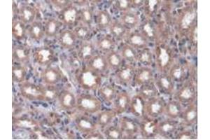 IHC-P analysis of Rat Kidney Tissue, with DAB staining.