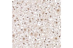 Immunohistochemistry of paraffin-embedded mouse liver using [KO Validated] PRMT4/C Rabbit pAb (ABIN1682307, ABIN3015886, ABIN3015887 and ABIN6219468) at dilution of 1:25 (40x lens). (CARM1 antibody  (AA 409-608))