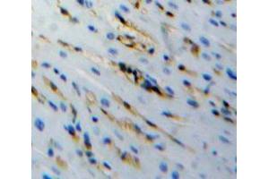 Used in DAB staining on fromalin fixed paraffin-embedded stomach tissue (PCOLCE2 antibody  (AA 154-269))