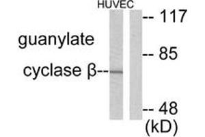 Western blot analysis of extracts from HuvEc cells, using Guanylate Cyclase beta Antibody. (GUCYB antibody  (AA 10-59))