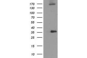 Western Blotting (WB) image for anti-Nudix (Nucleoside Diphosphate Linked Moiety X)-Type Motif 6 (NUDT6) antibody (ABIN1499864) (NUDT6 antibody)