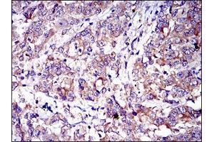 Immunohistochemistry (IHC) image for anti-CD6 (CD6) (AA 472-668) antibody (ABIN1098118)