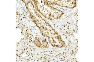 Immunohistochemistry (IHC) image for anti-Topoisomerase (DNA) II Binding Protein 1 (TOPBP1) (AA 1253-1522) antibody (ABIN6149398)