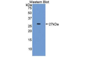 Western Blotting (WB) image for anti-Interferon, gamma-Inducible Protein 16 (IFI16) (AA 465-671) antibody (ABIN1859254) (IFI16 antibody  (AA 465-671))