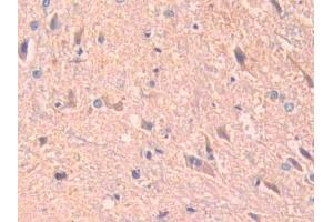 IHC-P analysis of Rat Spinal cord Tissue, with DAB staining. (ADAM10 antibody  (AA 218-445))