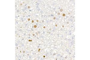 Immunohistochemistry of paraffin-embedded mouse liver using [KO Validated] CDKN1A/p21CIP1 Rabbit mAb (ABIN7266599) at dilution of 1:100 (40x lens). (p21 antibody)