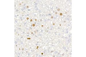 Immunohistochemistry of paraffin-embedded mouse liver using [KO Validated] CDKN1A/p21CIP1 Rabbit mAb (ABIN7266599) at dilution of 1:100 (40x lens).