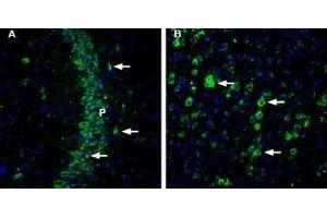 Expression of CHERP in mouse brain - Immunohistochemical staining of mouse brain sections using Anti-CHERP Antibody (ABIN7043011, ABIN7044119 and ABIN7044120). (CHERP antibody  (Cytosolic))
