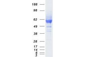 Western Blotting (WB) image for Scavenger Receptor Class B, Member 1 (SCARB1) (Transcript Variant 1) protein (Myc-DYKDDDDK Tag) (ABIN2731446)