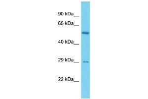 Host: Rabbit Target Name: C19orf66 Sample Type: ACHN Whole cell lysates Antibody Dilution: 1.