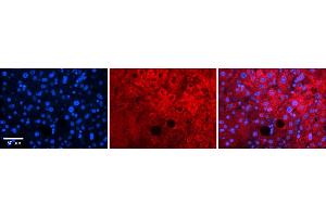 Rabbit Anti-Pard6b Antibody    Formalin Fixed Paraffin Embedded Tissue: Human Adult liver  Observed Staining: Cytoplasmic,Membrane Primary Antibody Concentration: 1:600 Secondary Antibody: Donkey anti-Rabbit-Cy2/3 Secondary Antibody Concentration: 1:200 Magnification: 20X Exposure Time: 0. (PARD6B antibody  (N-Term))