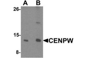 Western blot analysis of CENPW in HeLa cell lysate lysate with CENPW Antibody  at (A) 0. (CENPW antibody  (N-Term))