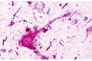 Image no. 1 for anti-Purinergic Receptor P2Y, G-Protein Coupled, 1 (P2RY1) (Extracellular Domain) antibody (ABIN1049200)