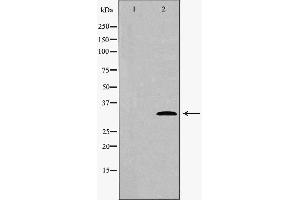 Western blot analysis of extracts of hela , using CDK4 antibody. (CDK4 antibody  (Internal Region))