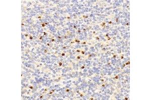 Immunohistochemistry of paraffin embedded mouse spleen using IL-23R (ABIN7074355) at dilution of 1:200 (400x lens) (IL23R antibody)
