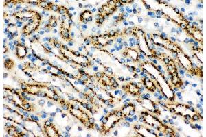 Anti-Cathepsin D Picoband antibody,  IHC(P): Mouse Kidney Tissue (Cathepsin D antibody  (AA 65-410))