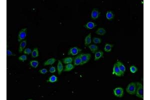 Immunofluorescent analysis of PC-3 cells using ABIN7172957 at dilution of 1:100 and Alexa Fluor 488-congugated AffiniPure Goat Anti-Rabbit IgG(H+L) (TMIGD2 antibody  (AA 23-150))