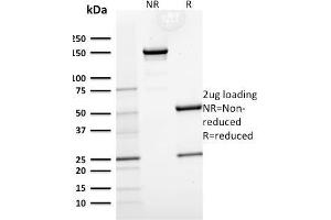 SDS-PAGE Analysis Purified Cytokeratin 15 Mouse Monoclonal Antibody (KRT15/2554). (KRT15 antibody)