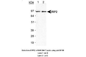 Image no. 2 for anti-Iron-Responsive Element Binding Protein 2 (IREB2) antibody (ABIN363497) (IREB2 antibody)