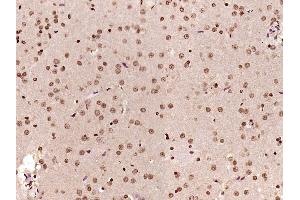 Paraformaldehyde-fixed, paraffin embedded Rat brain Antigen retrieval by boiling in sodium citrate buffer (pH6. (PP2A alpha/beta antibody  (pTyr307))