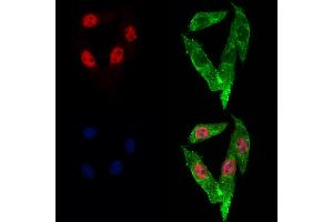 ABIN6262989 and ABIN6273053 staining Hela cells by IF/ICC.