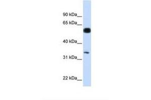 Image no. 1 for anti-BRISC and BRCA1 A Complex Member 1 (BABAM1) (AA 36-85) antibody (ABIN6749759) (BRISC and BRCA1 A Complex Member 1 (BABAM1) (AA 36-85) antibody)
