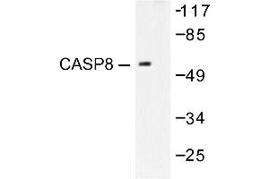 Image no. 1 for anti-Caspase 8 (CASP8) antibody (ABIN271875) (Caspase 8 antibody)