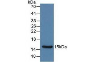 Detection of Recombinant Calcitonin, Rat using Monoclonal Antibody to Calcitonin (CT) (Calcitonin antibody  (AA 85-116))