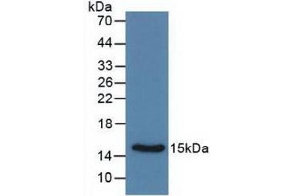 Calcitonin antibody  (AA 85-116)