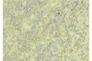 ABIN6276755 at 1/100 staining Mouse liver tissue by IHC-P. (Hepcidin antibody  (Internal Region))