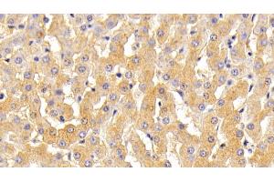 Detection of TF in Bovine Liver Tissue using Polyclonal Antibody to Transferrin (TF) (Transferrin antibody  (AA 284-575))