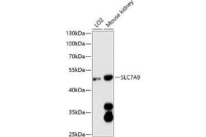 Western blot analysis of extracts of various cell lines, using SLC7 antibody (ABIN6130697, ABIN6148048, ABIN6148049 and ABIN6216625) at 1:3000 dilution. (SLC7A9 antibody  (AA 1-100))