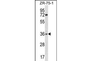 XRCC2 Antibody (N-term) (ABIN1882001 and ABIN2838361) western blot analysis in ZR-75-1 cell line lysates (35 μg/lane). (XRCC2 antibody  (N-Term))