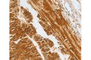 Immunohistochemistry (IHC) image for anti-Complement Factor H-Related 1 (CFHR1) (AA 151-330) antibody (ABIN6219787) (CFHR1 antibody  (AA 151-330))