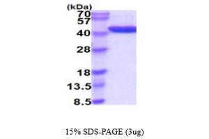 SDS-PAGE (SDS) image for Alcohol Dehydrogenase 1A (Class I), alpha Polypeptide (ADH1A) (AA 1-375) protein (His tag) (ABIN5854753) (ADH1A Protein (AA 1-375) (His tag))