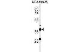 Western Blotting (WB) image for anti-Dehydrogenase/reductase (SDR Family) Member 7 (DHRS7) antibody (ABIN3002129) (DHRS7 antibody)