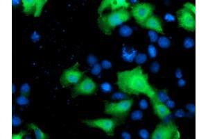 Anti-NEK9 mouse monoclonal antibody (ABIN2454885) immunofluorescent staining of COS7 cells transiently transfected by pCMV6-ENTRY NEK9 (RC211326). (NEK9 antibody)