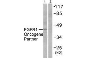 Western blot analysis of extracts from HepG2 cells, using FGFR1 Oncogene Partner Antibody.