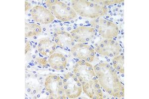 Immunohistochemistry of paraffin-embedded mouse kidney using ADIPOQ Antibody (ABIN5971370) at dilution of 1/100 (40x lens). (ADIPOQ antibody)
