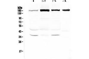 Western blot analysis of IQGAP2 using anti-IQGAP2 antibody .