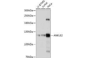Western blot analysis of extracts of various cell lines, using  antibody (ABIN7265603) at 1:1000 dilution. (ANKLE2 antibody  (AA 350-450))