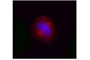 Immunofluorescence (IF) image for anti-Valosin Containing Protein (VCP) antibody (ABIN2666418) (VCP antibody)