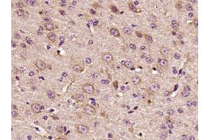 Paraformaldehyde-fixed, paraffin embedded mouse brain, Antigen retrieval by boiling in sodium citrate buffer (pH6) for 15min, Block endogenous peroxidase by 3% hydrogen peroxide for 30 minutes,  Blocking buffer (normal goat serum) at 37°C for 20min, Antibody incubation with HER3 (Tyr1289) Polyclonal Antibody(bs-3491R) at 1:400 overnight at 4°C, followed by a conjugated secondary and DAB staining. (ERBB3 antibody  (pTyr1289))