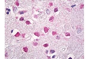 Immunohistochemistry (IHC) image for anti-High Mobility Group Box 1 (HMGB1) antibody (ABIN1102112)