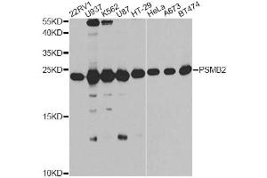 Western blot analysis of extracts of various cell lines, using PSMB2 antibody (ABIN6291444) at 1:1000 dilution. (PSMB2 antibody)